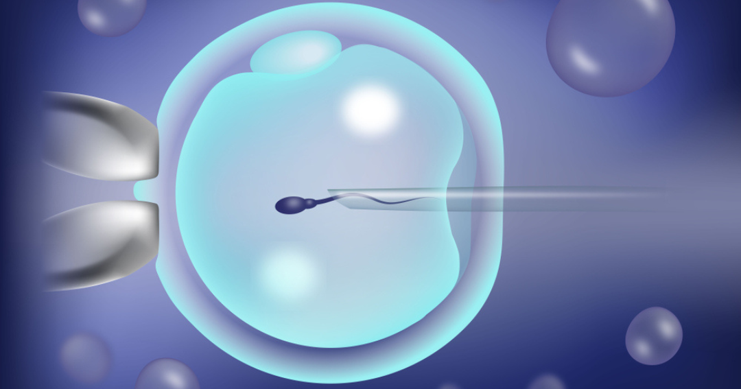 Intracytoplasmic sperm injection (ICSI) Karma Clinic - Dr Ahmed Moheb